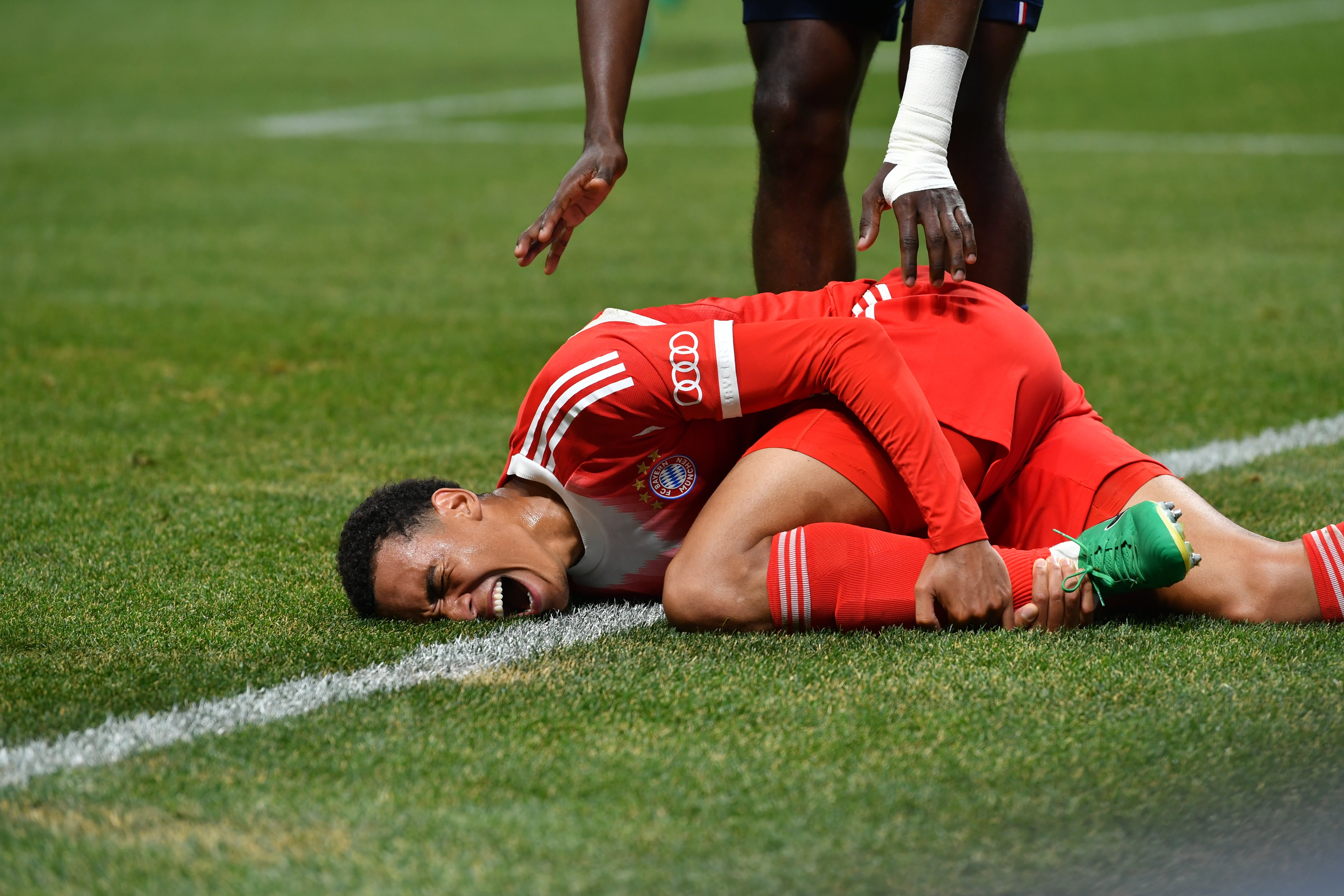 納格爾斯曼：穆西亞拉的傷勢對我們所有人來(lái)說(shuō)是巨大的打擊