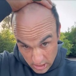 太陽(yáng)報：前美國國腳多諾萬(wàn)為脫發(fā)苦惱，向粉絲求助幫忙挑假發(fā)