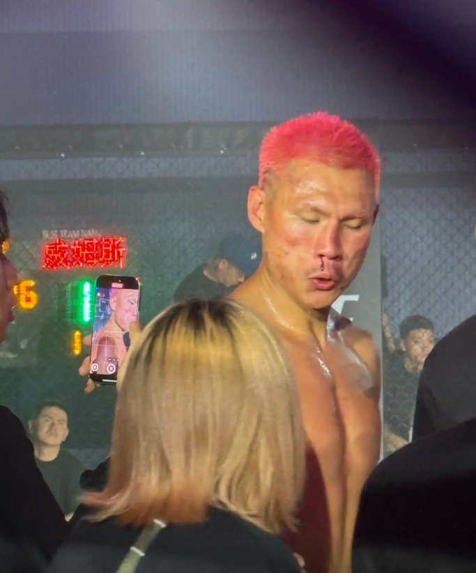 ??骨折了？惡鼠被威姆斯一拳打到面門(mén)！鼻梁已經(jīng)出現嚴重歪斜！